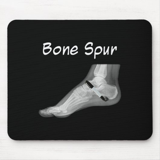 切り株の骨拍動インクペンおもしろいアンチ切り株 マウスパッド (正面)