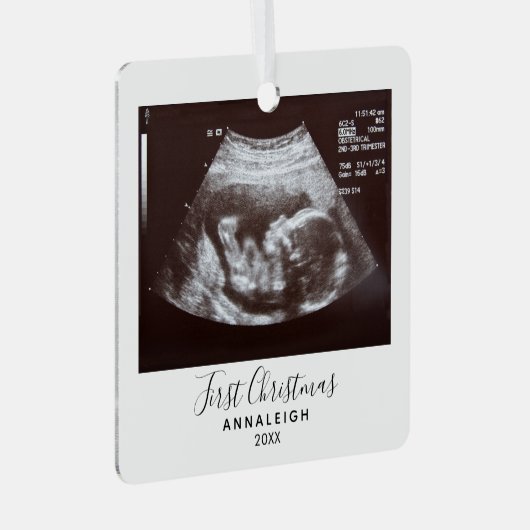 初めてのクリスマス妊娠超音波写真休日 メタルオーナメント (正面右)