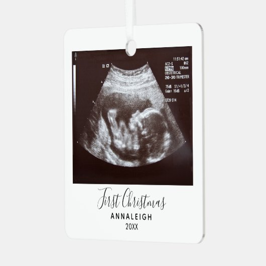 初めてのクリスマス妊娠超音波写真休日 メタルオーナメント (正面左)