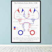 前庭眼反射VOR眼運動を安定化 キャンバスプリント (インサイチュ (ウッドフロア))