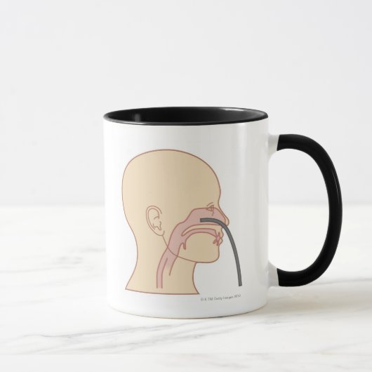 前方のRhinoscopy マグカップ (右)