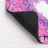 前立腺-ハート、私は組織学を愛します! マウスパッド (コーナー)