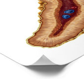 副腎の解剖学、横断面 ポスター (角)