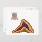 副腎の解剖学、横断面 ポストカード (正面/裏面)