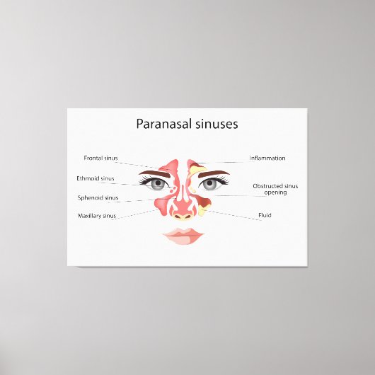 副鼻腔 キャンバスプリント (正面)