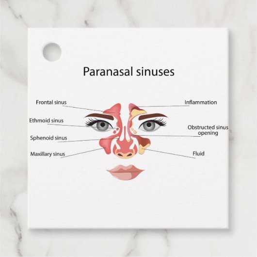 副鼻腔 フェイバータグ (正面)