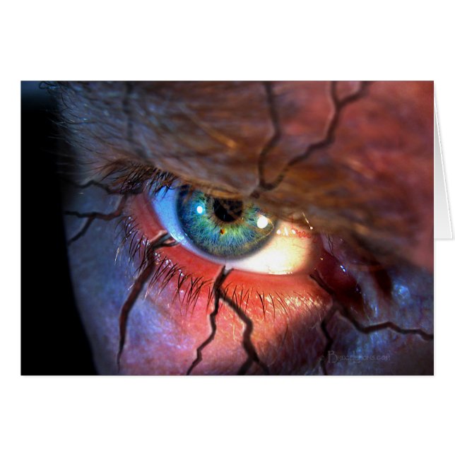 割れた目 (正面横)