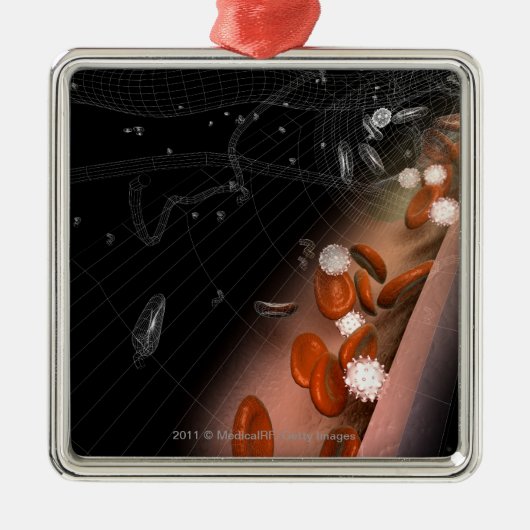 動脈のプラク メタルオーナメント (正面)