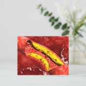 動脈の内部の脂肪斑の顕微鏡的見解 ポストカード (スタンド正面)