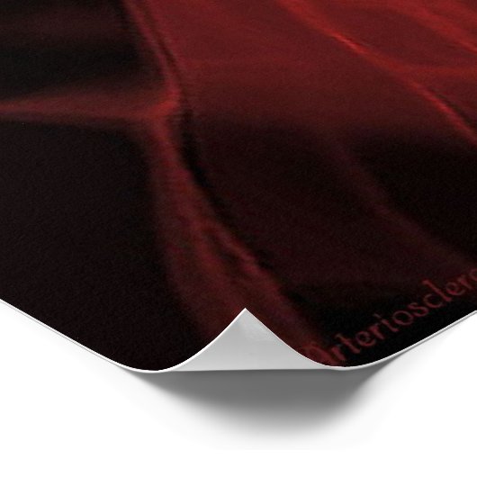 動脈硬化 ポスター (角)