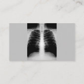 医学の放射線学のモダン2の側面 名刺 (裏面)