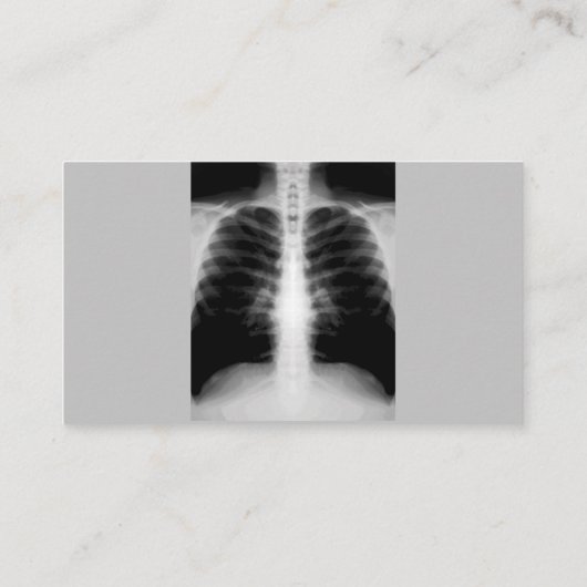 医学の放射線学のモダン2の側面 名刺 (裏面)
