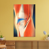 医用イラストレーション：膝の炎症 キャンバスプリント (インサイチュ (リビング))