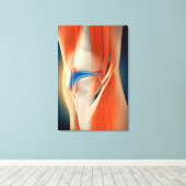 医用イラストレーション：膝の炎症 キャンバスプリント (インサイチュ (ウッドフロア))