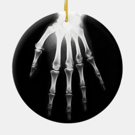 医用X線医師病院X線ハンド セラミックオーナメント (裏面)