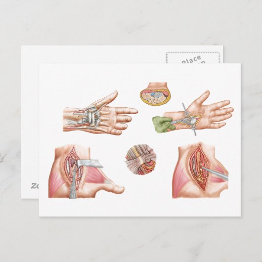 医療イラストレーションと手骨トンネル ポストカード (正面/裏面)