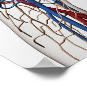 医療イラストレーション動脈1 ポスター (角)