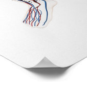 医療用イラストレーション動脈3 ポスター (角)