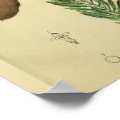 医療用手首外科腎解剖学プリント ポスター (角)