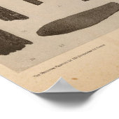 南カリフォルニアのXI骨の記事 ポスター (角)