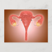 卵巣を持つ女性の子宮構造 ポストカード (正面)