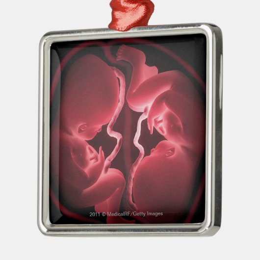 双生児を含んでいる子宮の概念的なイメージ メタルオーナメント (左)