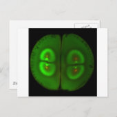 受精卵 ポストカード (正面/裏面)