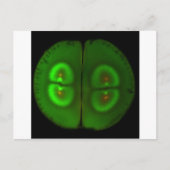 受精卵 ポストカード (正面)