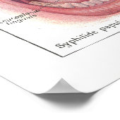 口内解剖学ポスターの病フランスの患 ポスター (角)