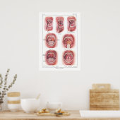 口内解剖学ポスターの病フランスの患 ポスター (キッチン)