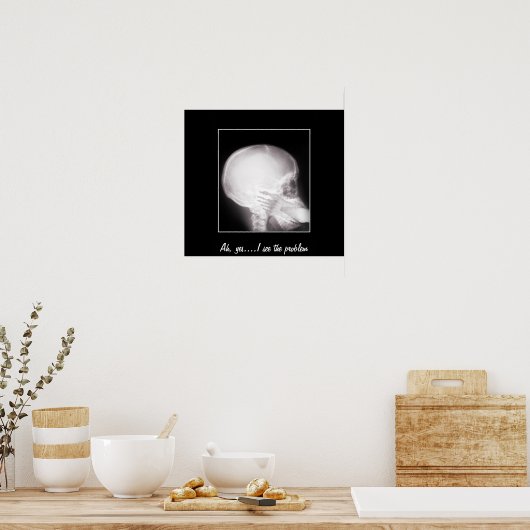 口腔X線中足 ポスター (キッチン)