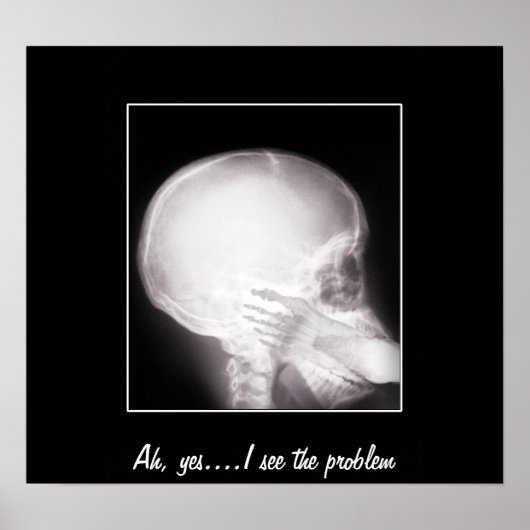 口腔X線中足 ポスター (正面)