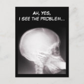 口腔X線中足 ポストカード (正面)