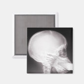 口腔X線中足 マグネット (正面/裏面)