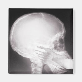 口腔X線中足 マグネット