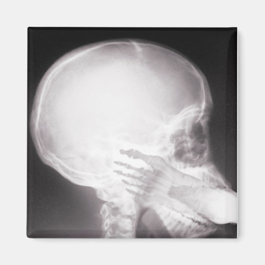 口腔X線中足 マグネット (正面)