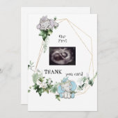 可愛い双子感謝してい超音波ベビー視点 サンキューカード (正面/裏面)