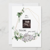 可愛い超感謝してい超音波ベビーガール視点 サンキューカード (正面)