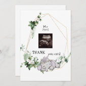 可愛い超感謝してい超音波ベビーガール視点 サンキューカード (正面/裏面)