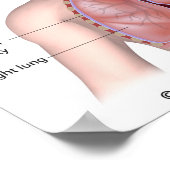 呼吸器系にはポスターが貼られている ポスター (角)