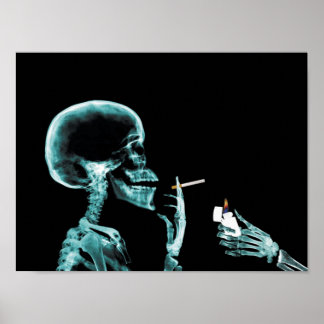 喫煙X線ポスター ポスター