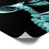 喫煙X線ポスター ポスター (角)