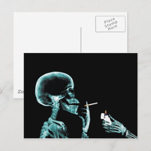 喫煙X線 ポストカード (正面/裏面)