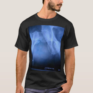 壊れた腿骨 Tシャツ