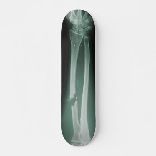 壊れた骨 スケートボード (正面)