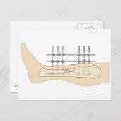 外付け固定具 ポストカード (正面/裏面)