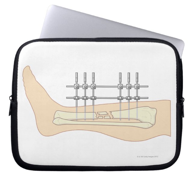 外付け固定具 ラップトップスリーブ (正面)