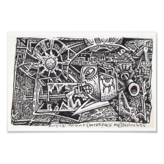 外科用インプラント（インタフェースMe）技術 フォトプリント (正面)