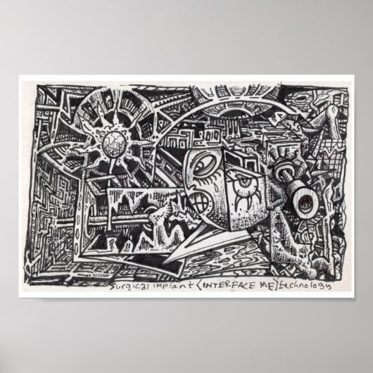 外科用インプラント（インタフェースMe）技術。 ポスター (正面)