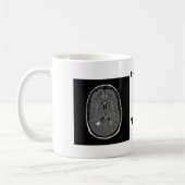 多発性硬化 コーヒーマグカップ (左)